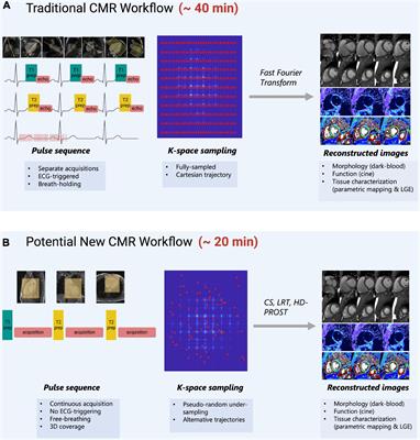 Simultaneous multi-parametric acquisition and reconstruction techniques in cardiac magnetic resonance imaging: Basic concepts and status of clinical development